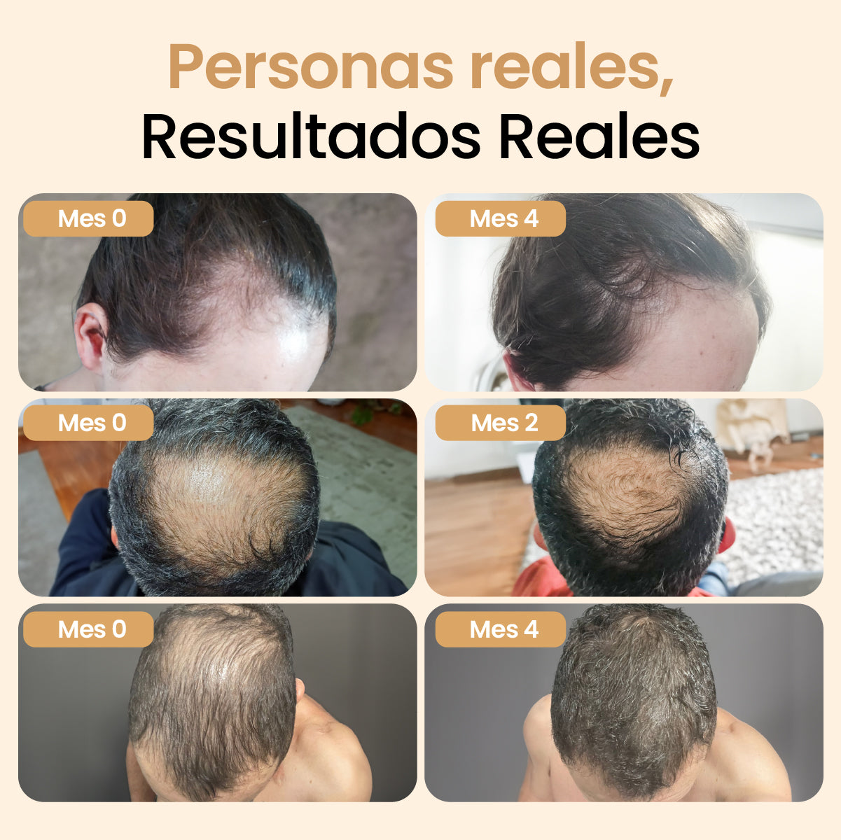 Activador Capilar con células madre de cúrcuma y oliva + Shampoo anti caída con cebolla