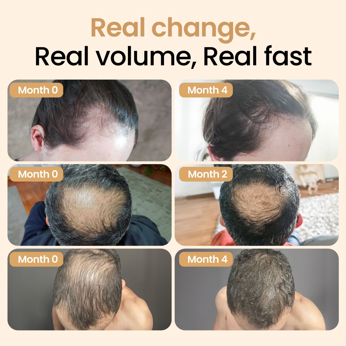 Hair Booster with Capilia Longa Stem Cells + Capillary Ampoule + Kerabless Hair Growth Complex
