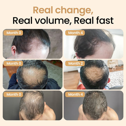 Hair Booster with Capilia Longa Stem Cells + Capillary Ampoule + Kerabless Hair Growth Complex