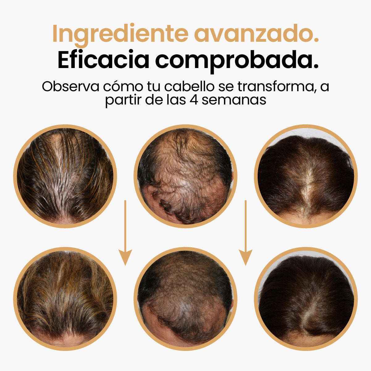 Activador capilar con células madre de capilia longa, factores de crecimiento - Pague 2, lleve 3