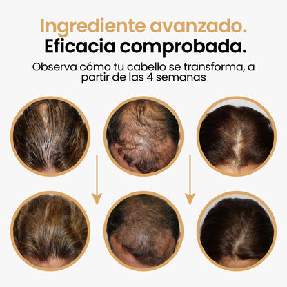 Activador capilar con células madre de capilia longa, factores de crecimiento - Pague 2, lleve 3
