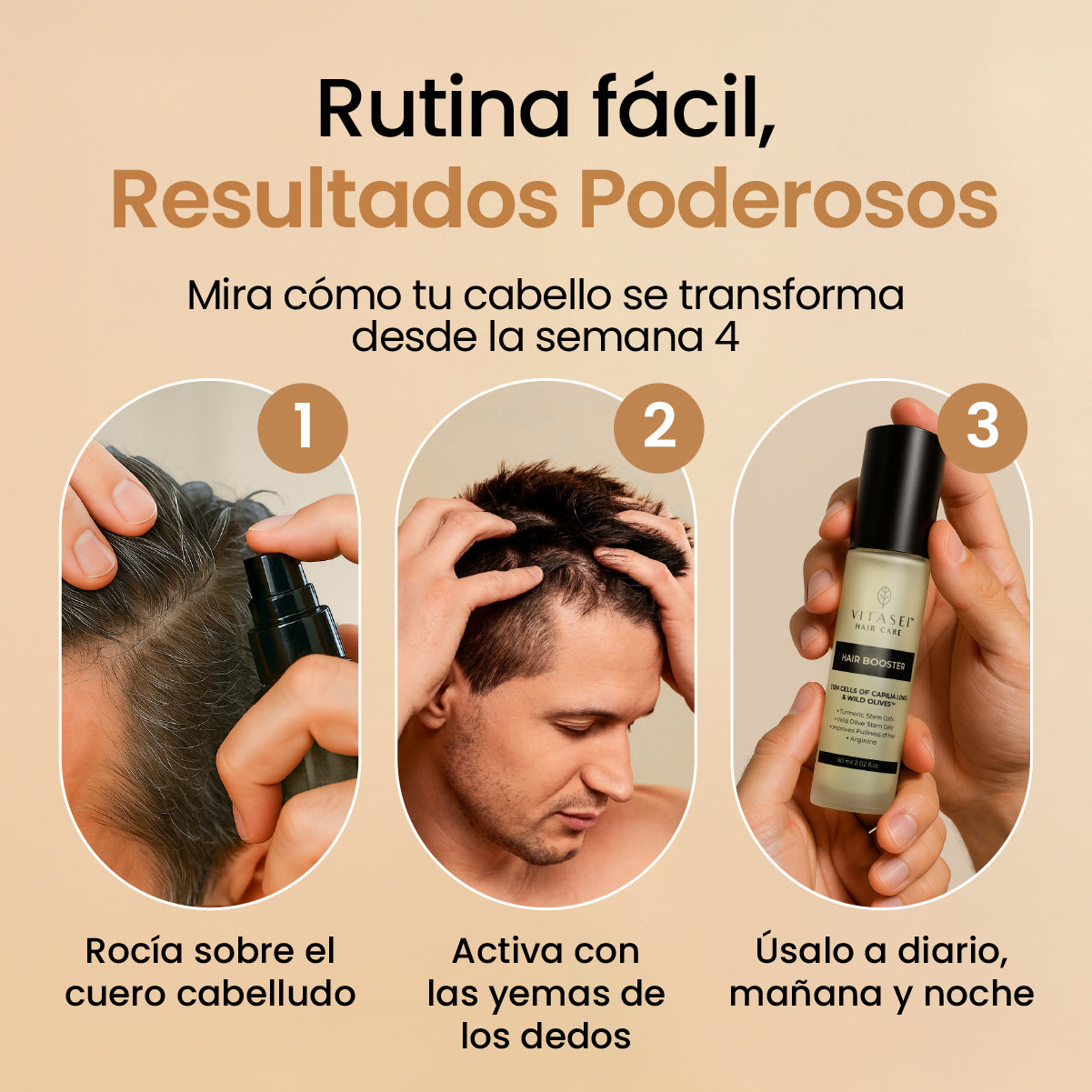 Shampoo de cebolla + acondicionador + activador de crecimiento capilar