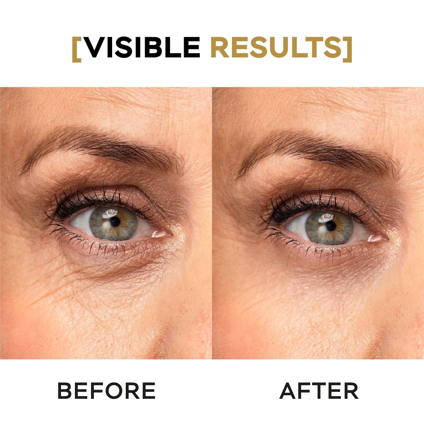 DAY AND NIGHT FACIAL SERUM + DAY AND NIGHT EYE CONTOUR + GET NECK SERUM FREE