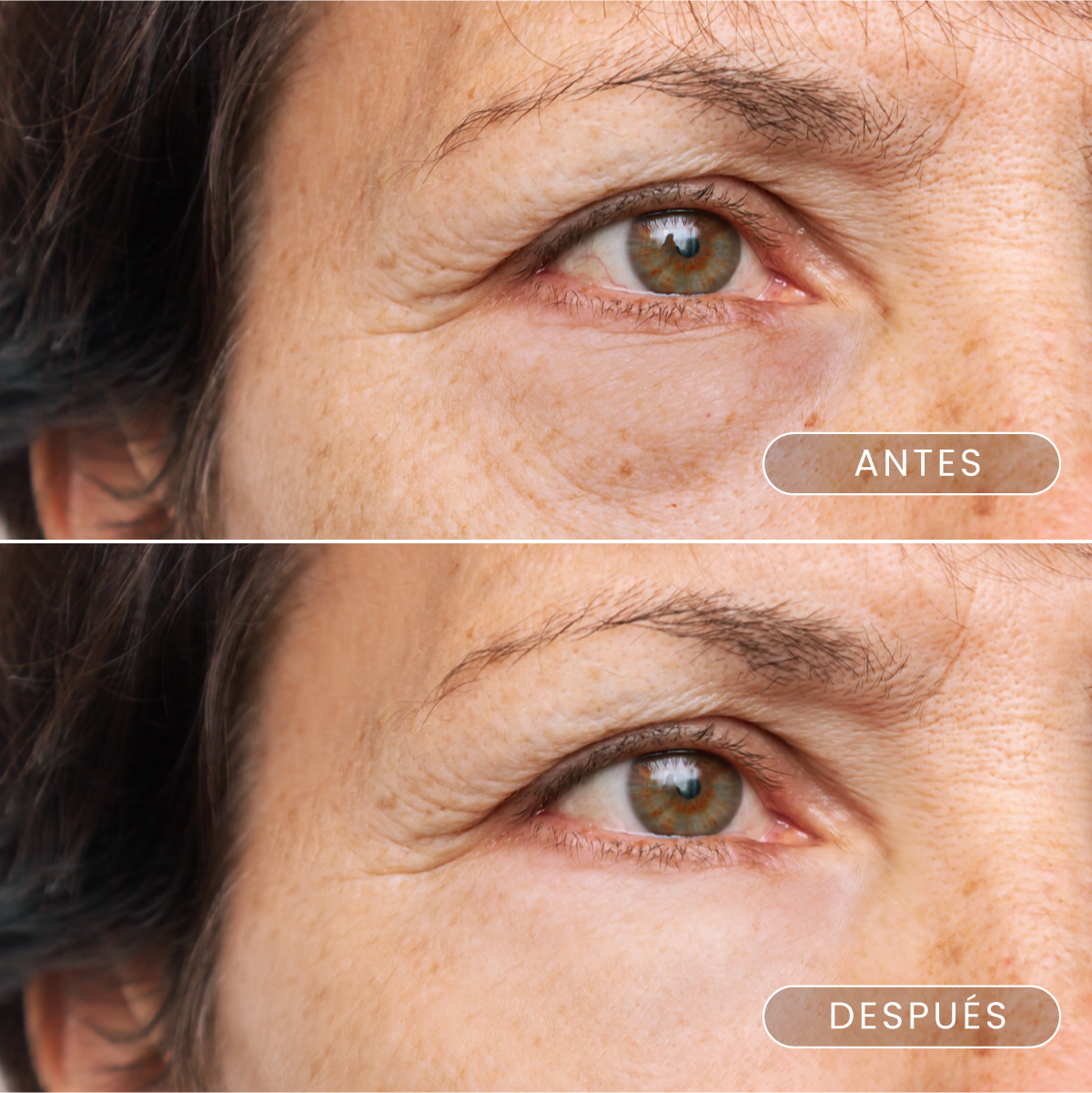 Nuevos parches reafirmantes para ojos con caviar y cristales de colágeno