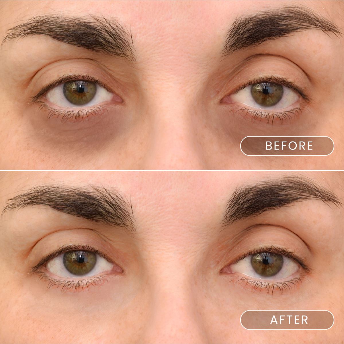Buy 2 black gold firming eyemask patch with caviar and collagen crystals and gen 1 FREE