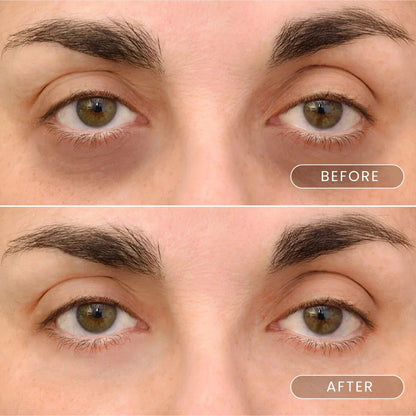 Day and night serums with apple stem cells +  Eyemask patch with caviar and collagen crystals + Magnetic mask with dead sea mud