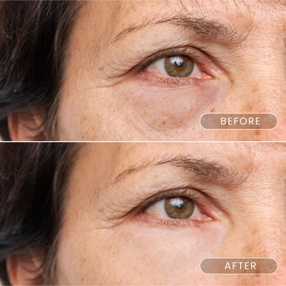 Buy 2 black gold firming eyemask patch with caviar and collagen crystals and gen 1 FREE