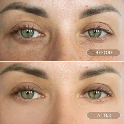 Day and night serums with apple stem cells +  Eyemask patch with caviar and collagen crystals + Magnetic mask with dead sea mud