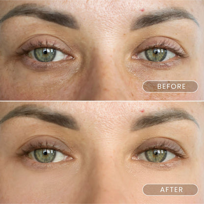 Buy 2 black gold firming eyemask patch with caviar and collagen crystals and gen 1 FREE