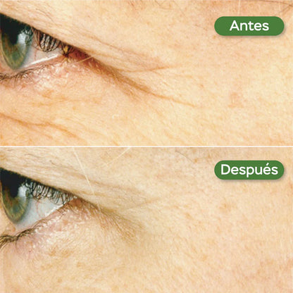Suero facial noche antiedad con retinol y células madre de manzana