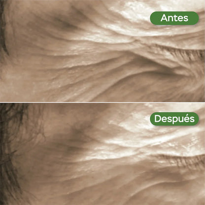 Suero facial noche antiedad con retinol y células madre de manzana