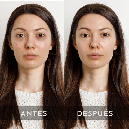 Tónico facial Iluminador con niacinamida, vitamina C y arbutina
